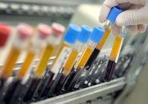 اسامی 15 دوپینگی در سال 2025