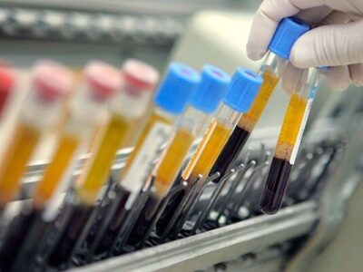 نیمی از دوپینگ‌ها متعلق به کشتی!